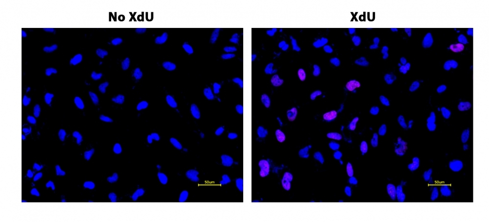 S-phase HeLa cells were detected with Bucculite&trade; XdU Cell Proliferation Fluorescence Imaging Kit (Cat#22328). HeLa cells at 50,000 cells/well/100 &mu;L were seeded overnight in a 96-well black wall/clear bottom plate. Cells were treated with XdU at 37 &ordm;C for 3 hours, and fixed with Methanol/PBS (90/10).&nbsp; After fixation, cells were stained with iFluor® 647-MTA for 30 min in staining buffer, and then washed three times with 1X washing Buffer. 100 &micro;L 5 &micro;g/ml Hoechst 33342 solution in 1X Washing Buffer were added to each well and the fluorescence images were visualized with Cy5 filter for S phase cells (Red) and with DAPI filter nuclear for all cells (Blue).