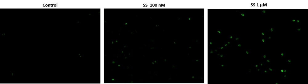 Fluorescence images of TUNEL reaction in HeLa cells with the treatment of 100 nM or 1 &mu;M staurosporine (SS) for 4 hours as compare to untreated control. Cells were incubated with TUNEL working solution for 1 hour at 37&ordm;C. The green fluorescence signal was analyzed using fluorescence microscope with a FITC filter set. Fluorescently labeled DNA strand breaks shows intense fluorescent staining in SS treated cells.
