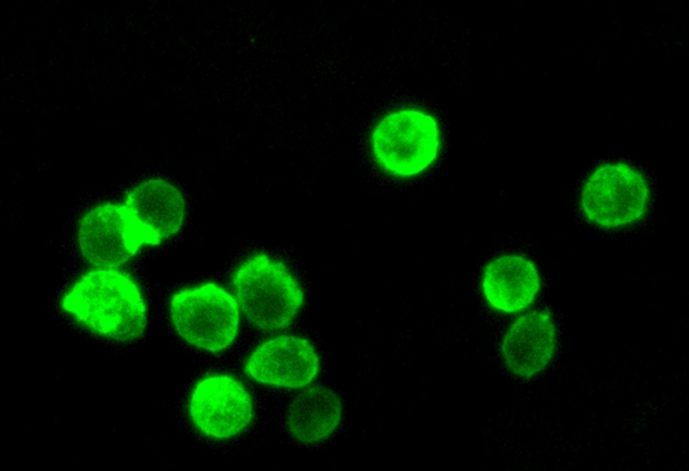 Fluorescence images of HL-60 cells stained with Cell Navigator® Cell Plasma Membrane Staining Kit *Green Fluorescence* in a 96-well black wall/clear bottom plate. The cells were imaged using a fluorescence microscope equipped with a FITC filter set.<br />&nbsp;
