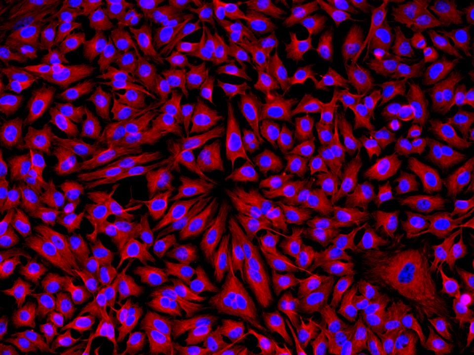 HeLa cells were incubated with rabbit&nbsp;anti-tubulin followed by Cy3<sup>&reg;</sup> goat anti-rabbit IgG conjugate. Cell nuclei were stained with Hoechst 33342 (Blue, Cat# 17530).