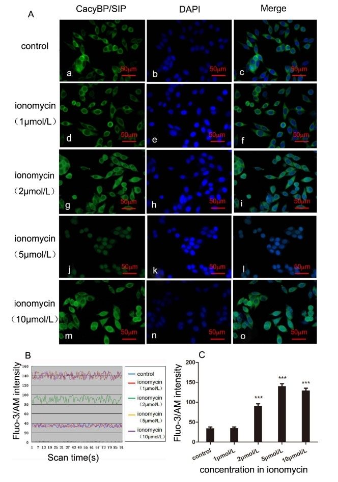 <strong>Effect of increased [Ca<sup>2+</sup>]i on the subcellular localization of CacyBP/SIP in colon cancer SW480 cells.&nbsp;</strong>(A) Effect of different concentrations of ionomycin on the localization of endogenous CacyBP/SIP. Cells were treated with ionomycin for 30 min, followed by immunostaining using anti-CacyBP/SIP, and were imaged with confocal microscopy. CacyBP/SIP was translocated to the perinuclear region in SW480 cells. After stimulation with an increasing amount of ionomycin (0, 1, 2, 5, 10 &mu;mol/L) for 30 min at 37&deg;C, SW480 cells were fixed and immunostained using CacyBP/SIP MAb (panels a, d, g, j, and m), and nuclei were labelled with DAPI (panels b, e, h, k, and n). The merged images are shown in panels c, f, i, l, and o. The scale bar represents 50 &mu;m. (B) The intensity of cytosolic free intracellular Ca<sup>2+</sup> fluorescence in SW480 cells treated with ionomycin (0, 1, 2, 5, 10 &mu;mol/L). The Fluo-3 fluorescence intensity in SW480 cells reached a plateau at 5 &mu;mol/L and 10 &mu;mol/L of ionomycin. SW480 cells were loaded with 20 &mu;mol/L of Fluo-3/AM for 45 min under a confocal microscope (495 nm). The fluorescence was captured every 2 sec and recorded for 3 min. (C) The bar chart shows the intracellular Fluo-3 intensity. Ca<sup>2+</sup> concentration is increased by treatment with 2, 5, and 10 &mu;mol/L of ionomycin (***P&lt;0.001). Source:&nbsp;<strong>The effect of S100A6 on nuclear translocation of CacyBP/SIP in colon cancer cells</strong> by Shanshan Feng et al., <em>PLOS</em>, March 2018.