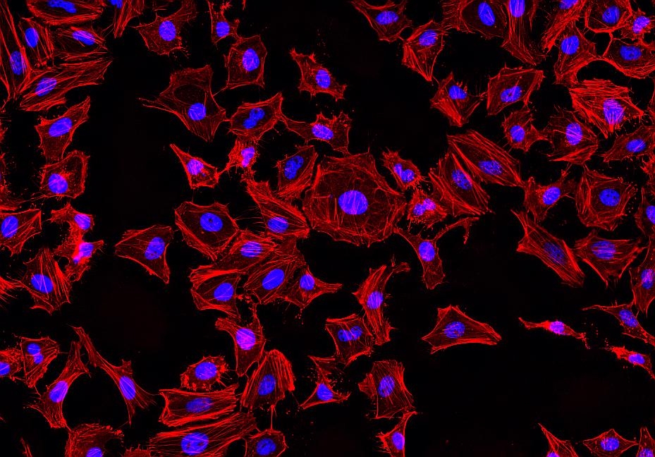 Fluorescence images of HeLa cells stained with Phalloidin-iFluor® 514 Conjugate using fluorescence microscope with a TRITC filter set (Red). Fixed cells were counterstained with Nuclear Blue&trade; DCS1 (Cat#17548, Blue).