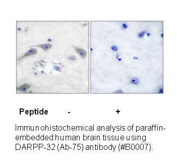 Product image for DARPP-32 (Ab-75) Antibody