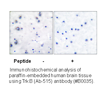 Product image for Trk B (Ab-515) Antibody