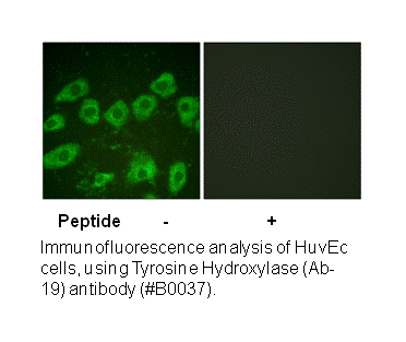 Product image for Tyrosine Hydroxylase (Ab-19) Antibody