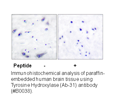 Product image for Tyrosine Hydroxylase (Ab-31) Antibody