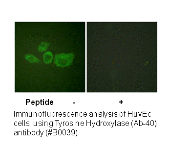 Product image for Tyrosine Hydroxylase (Ab-40) Antibody