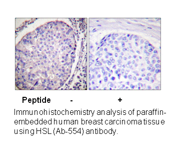 Product image for HSL (Ab-554) Antibody