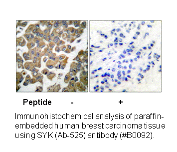 Product image for SYK (Ab-525) Antibody