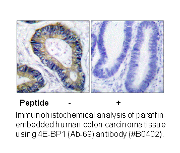 Product image for 4E-BP1 (Ab-69) Antibody