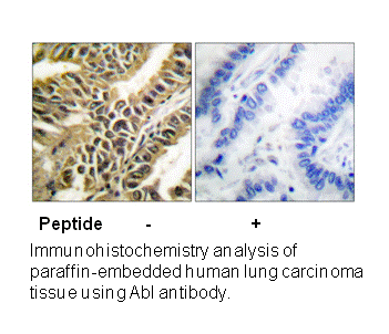 Product image for Abl (Ab-412) Antibody