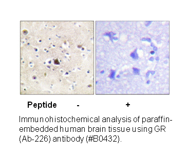 Product image for GR (Ab-226) Antibody