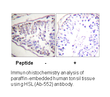 Product image for HSL (Ab-552) Antibody