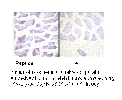 Product image for IKK-&alpha;/&beta; (Ab-176/177) Antibody