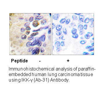 Product image for IKK-&gamma; (Ab-31) Antibody