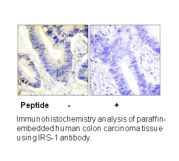 Product image for IRS-1 (Ab-612) Antibody