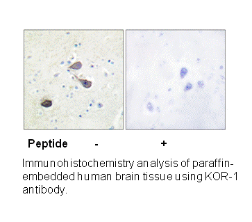 Product image for KOR-1 (Ab-369) Antibody