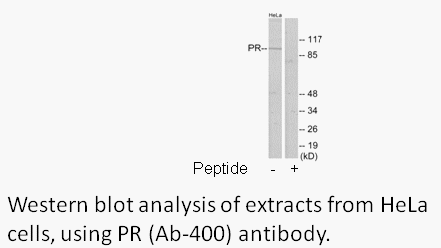 Product image for Progesterone Receptor (Ab-400) Antibody