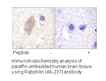 Product image for Rabphilin 3A (Ab-Ser237) Antibody