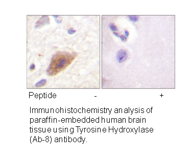 Product image for Tyrosine Hydroxylase (Ab-8) Antibody