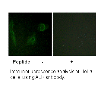 Product image for ALK (Ab-1604) Antibody