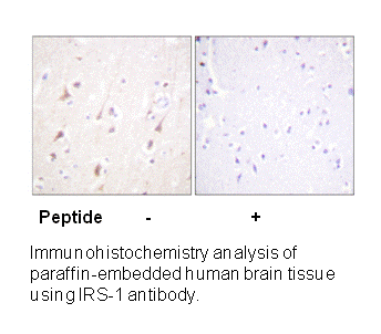 Product image for IRS-1 (Ab-794) Antibody