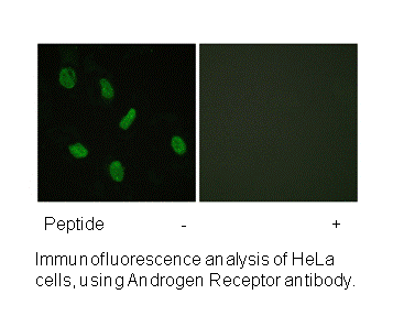 Product image for Androgen Receptor (Ab-94) Antibody