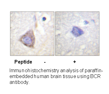 Product image for Bcr (Ab-360) Antibody