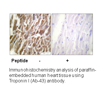 Product image for TNNI3 (Ab-43) Antibody