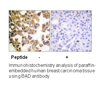 Product image for BAD (Ab-91/128) Antibody