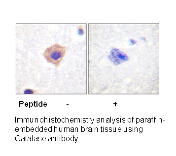 Product image for Catalase (Ab-385) Antibody