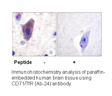 Product image for CD71/TfR (Ab-24) Antibody