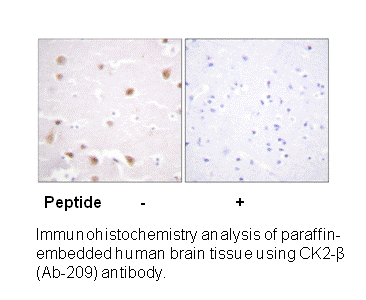 Product image for CKII-&beta; (Ab-209) Antibody