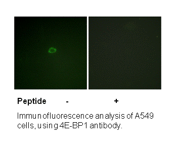 Product image for 4E-BP1 (Ab-36) Antibody