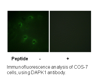 Product image for DAPK1 (Ab-308) Antibody