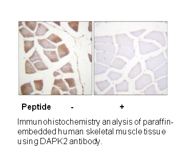 Product image for DAPK2 (Ab-318) Antibody