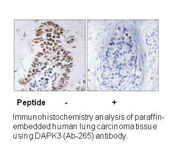 Product image for DAPK3 (Ab-265) Antibody