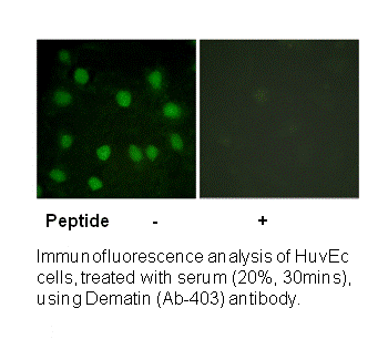 Product image for Dematin (Ab-403) Antibody