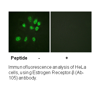 Product image for Estrogen Receptor-&beta; (Ab-105) Antibody