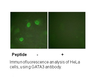 Product image for GATA3 (Ab-308) Antibody