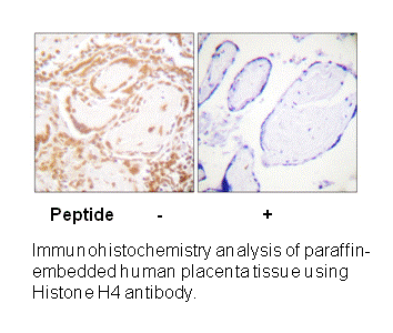 Product image for Histone H4 (Ab-47) Antibody