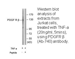 Product image for PDGFR &beta; (Ab-740) Antibody