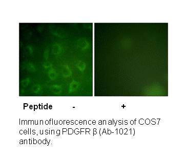 Product image for PDGFR &beta; (Ab-1021) Antibody