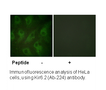 Product image for Kir6.2 (Ab-224) Antibody