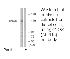 Product image for eNOS (Ab-615) Antibody