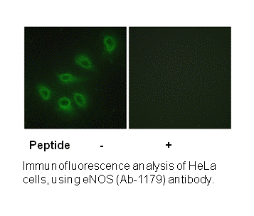 Product image for eNOS (Ab-1179) Antibody