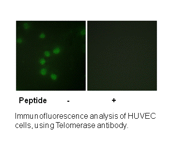 Product image for Telomerase (Ab-227) Antibody