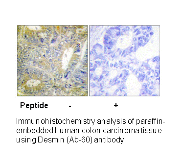 Product image for Desmin (Ab-60) Antibody