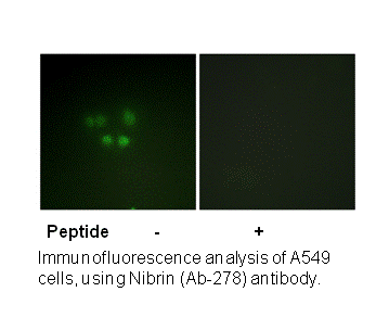 Product image for Nibrin (Ab-278) Antibody