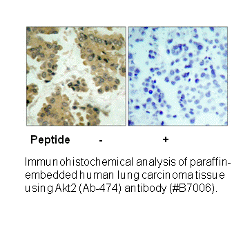 Product image for Akt2 (Ab-474) Antibody